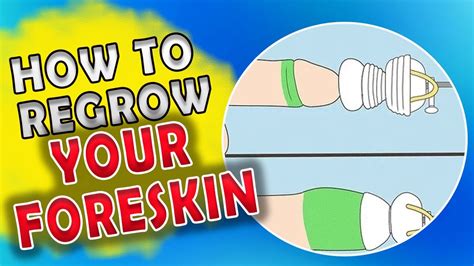 When I started restoring my inner foreskin remnant was one inch long. . Reddit foreskin restoration guide
